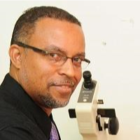 ophtgalmologist barbados cataract surgery